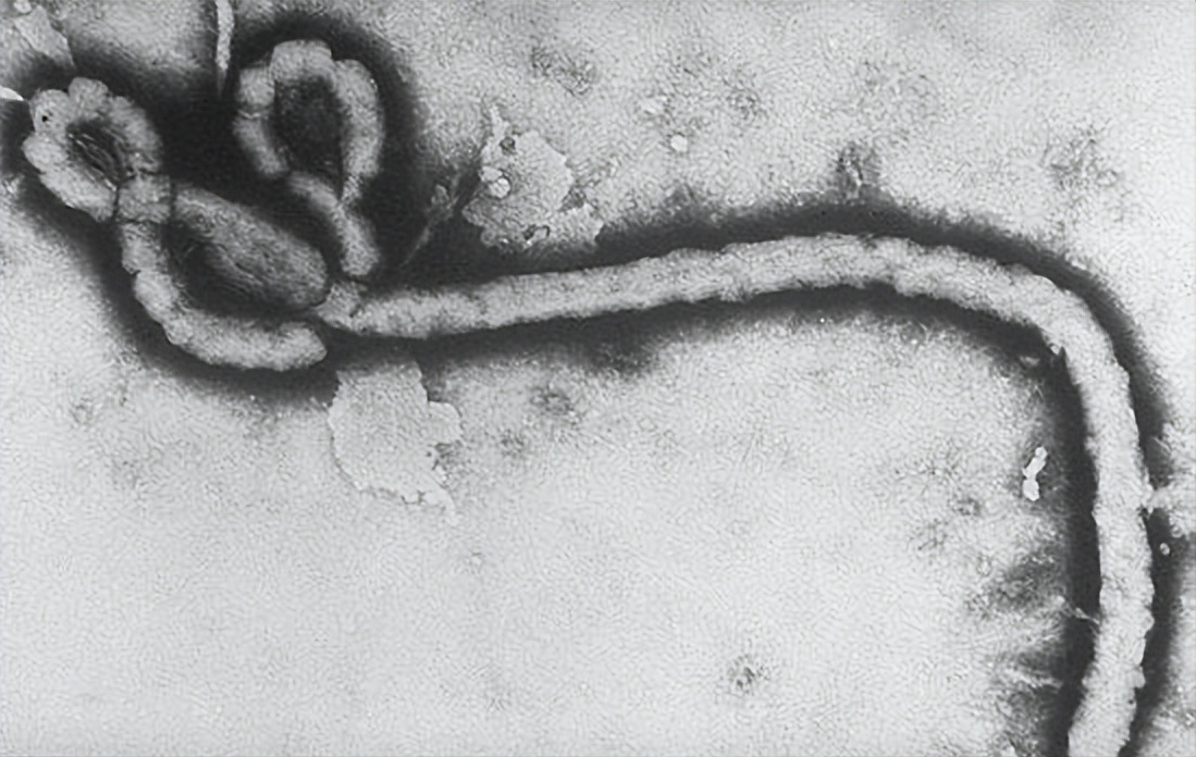 埃博拉病毒为什么突然消失（史上最强病毒埃博拉的来历） 11