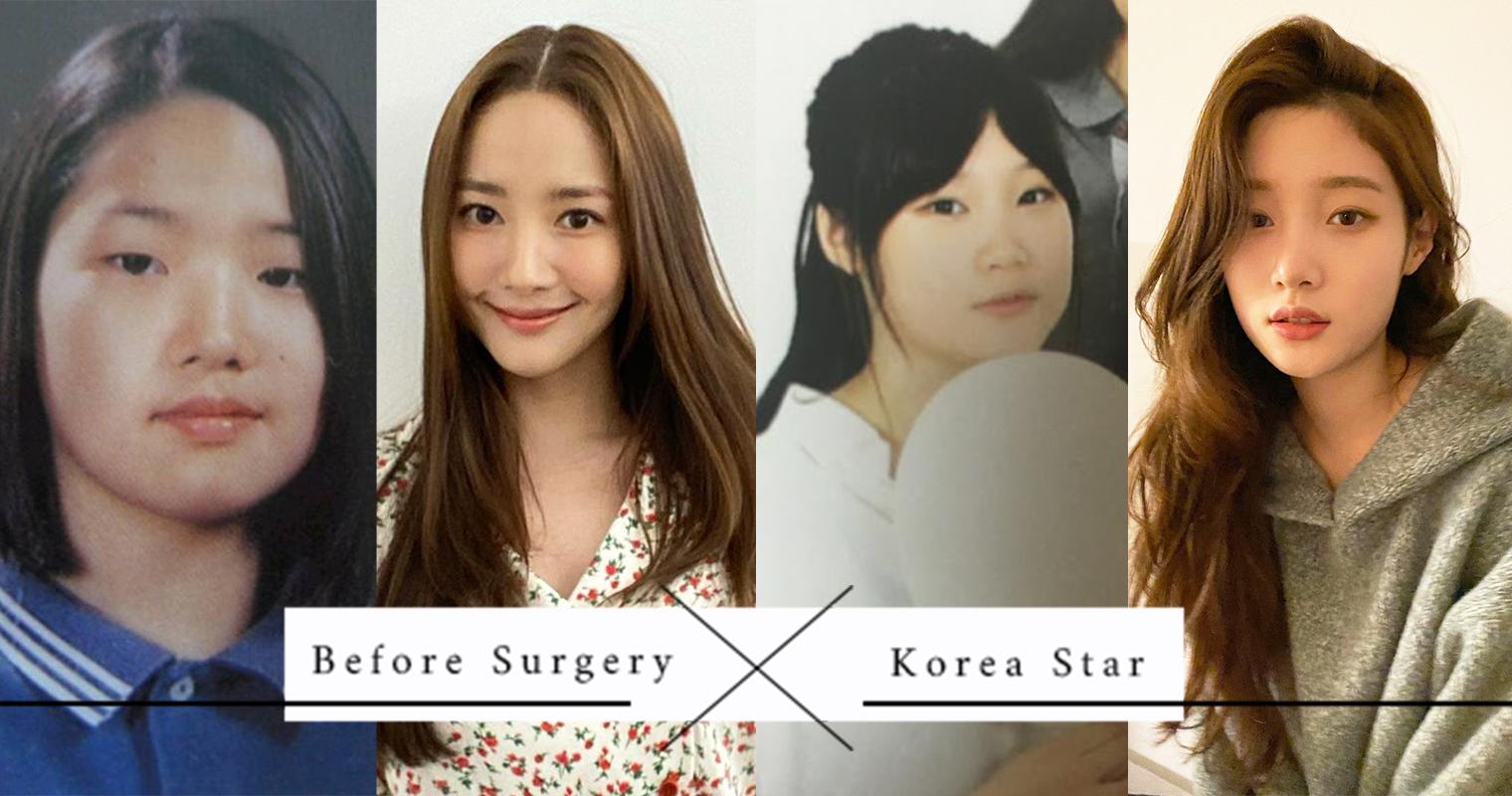 韩国女星整容照片（14位韩国女明星整形前后对比照） 1